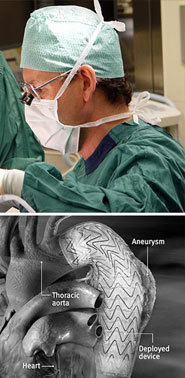 Gefäßchirurgie, BHB Linz, mit freundlicher Genehmigung von Fa. Gore 2012